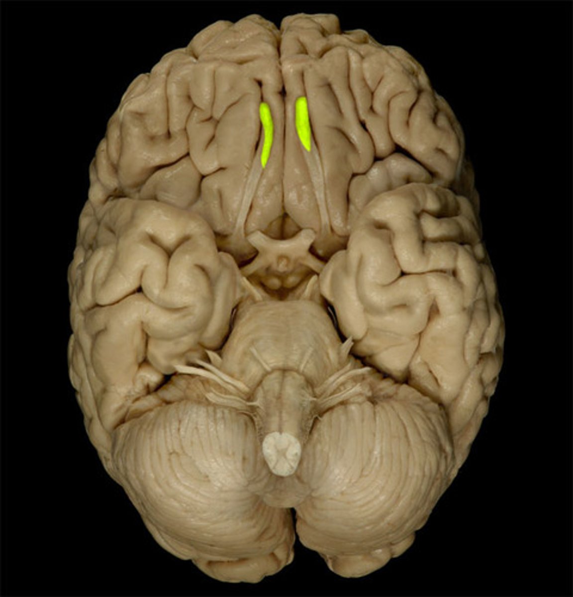 <p>located above the nasal cavity beneath frontal lobes; receives olfactory information from nose and transmits to brain via olfactory tract</p>