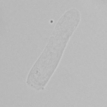 <p>Which type of cast is in the image below as described as "clear and colorless", composed mostly of protein, and a normal finding includes (0-2/LPF)</p>