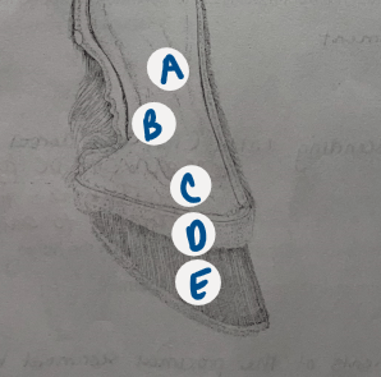 <p>Which represents the coronary dermis?</p>