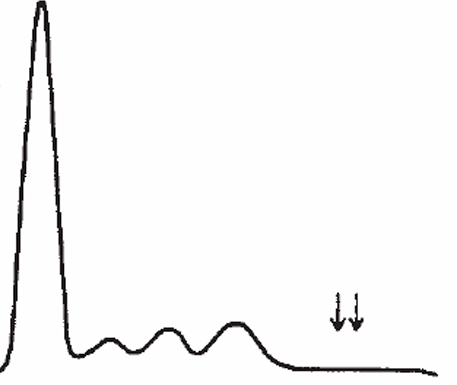 <p>What disease/ disorder is associated?</p>