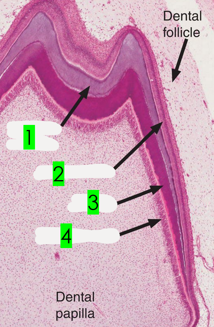 <p>What is arrow 3 pointing to?</p>