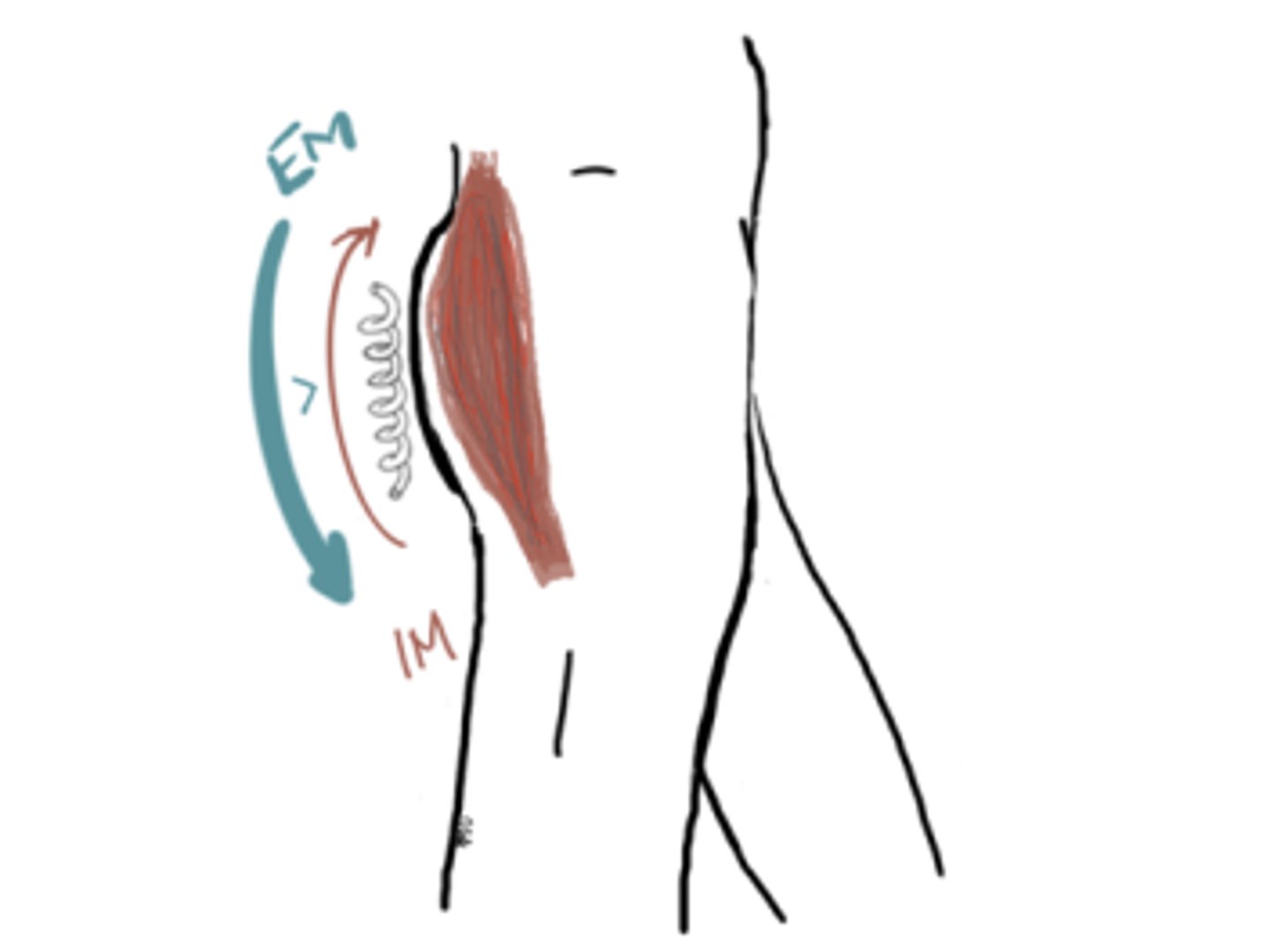 <p>IM: Extension moment (glutes)</p><p>EM: Flexion Moment</p><p>IM</p>