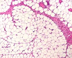 <p>What is this tissue?</p>