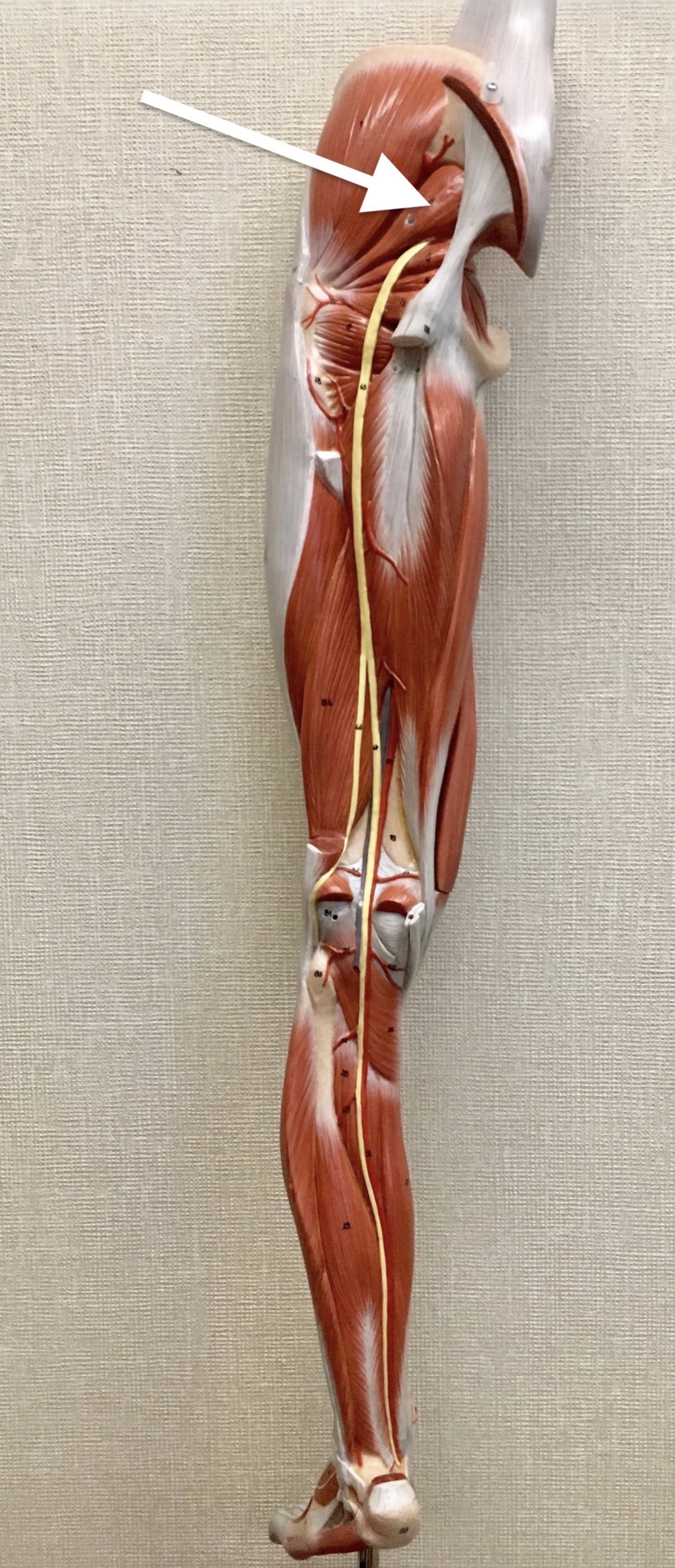 <p><span>Name the muscle labeled with the white arrow below AND name the origin .</span></p>