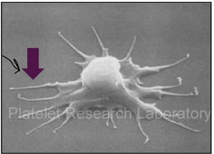 <ul><li><p><span style="background-color: transparent;"><span>Lifespan of around 10 days</span></span></p></li><li><p><span style="background-color: transparent;"><span>Disc shaped with a diameter of 2-3µm</span></span></p></li><li><p><span style="background-color: transparent;"><span>Pseudopodia allow for shape alteration and movement </span></span></p></li><li><p><span style="background-color: transparent;"><span>No nucleus but have mitochondria, ribosomes</span></span></p></li><li><p><span style="background-color: transparent;"><span>Granules are found in platelets:</span></span></p><ul><li><p><span style="background-color: transparent;"><span>Alpha granules: coagulation factors, adhesion molecules</span></span></p></li><li><p><span style="background-color: transparent;"><span>Dense granules: ADP, ATP, Ca</span><sup><span>2+</span></sup></span></p></li></ul></li></ul><p></p>