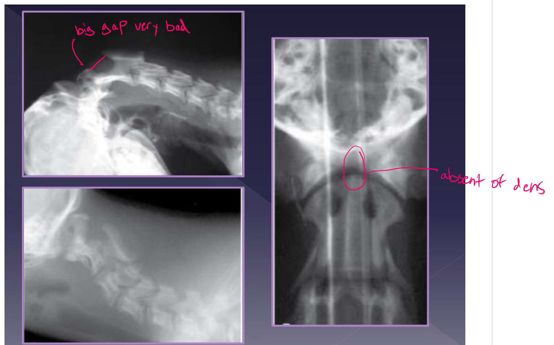 <ul><li><p>physical examination: <strong>Do not flex the neck! makes C2 go dorsally and makes pain worse in flexion of neck </strong></p></li><li><p>radiographs </p><ul><li><p>increased distance between dorsal arch of C1 and dorsal spinous process of C2 </p></li></ul></li><li><p>CT </p></li><li><p>MRI </p></li><li><p>differential diagnosis </p><ul><li><p>meningitis </p></li><li><p>syringomyelia </p></li><li><p>discospondylitis </p></li><li><p>disc disease </p></li></ul></li></ul><p></p>