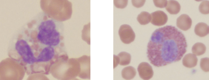 What type of leukocyte is this?