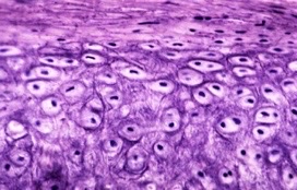 <p>What type of cartilage?</p>