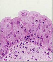 <p>what kind of epithelium is this </p>