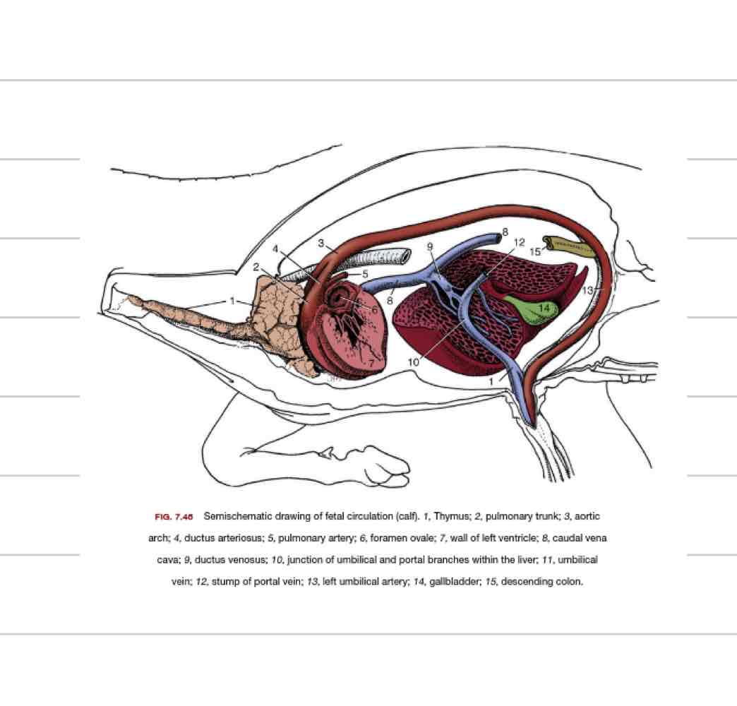 <ul><li><p>Shunt that bypasses the lungs</p></li><li><p>goes directly from pulmonary artery to aorta</p></li></ul>