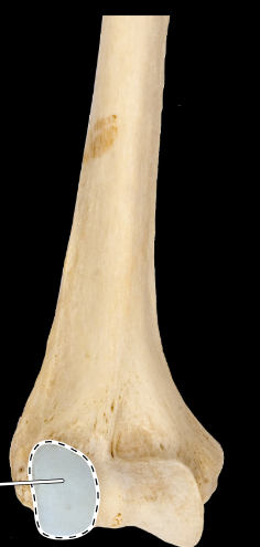 <p>Humerus, anterior view, right side, distal end</p>