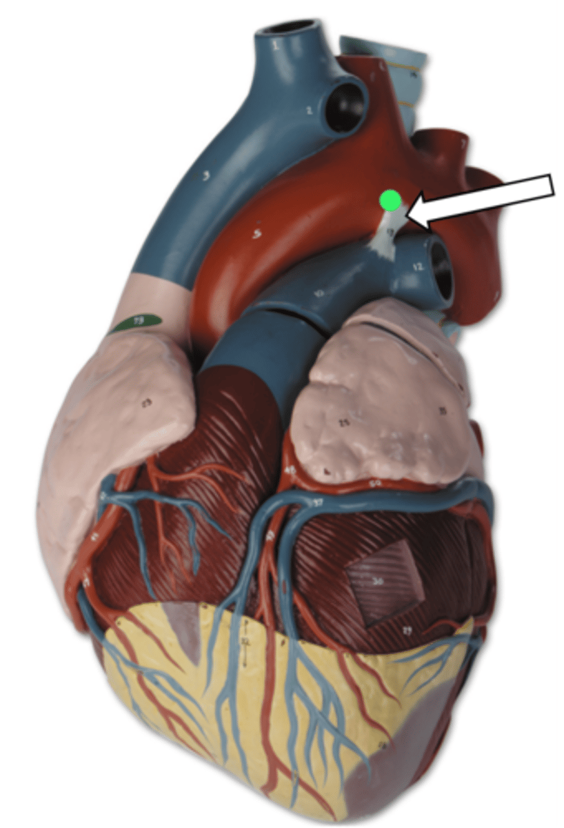 <p>name the structure</p>