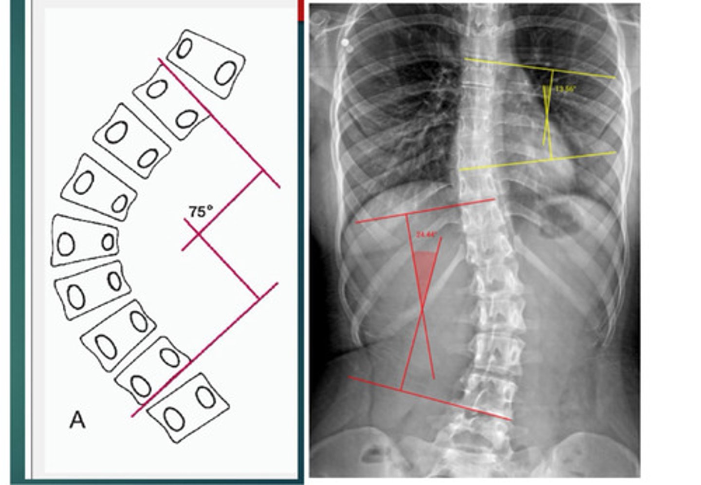 <p>What line of mensuration is this?</p>