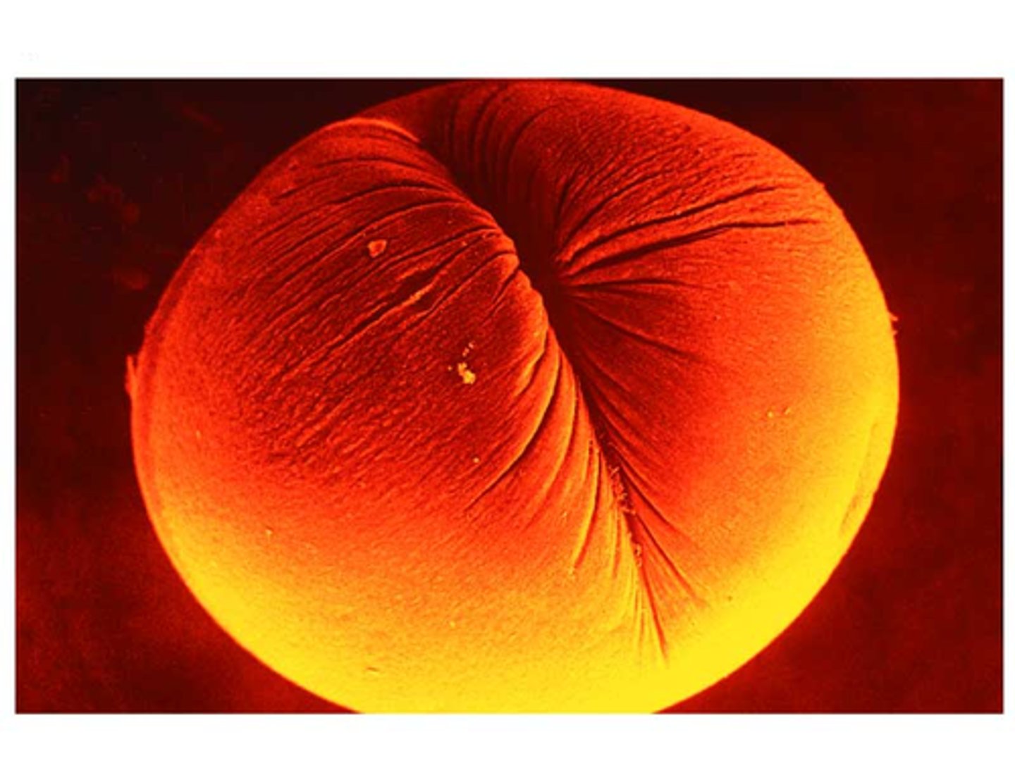 <p>The first sign of cleavage in an animal cell; a shallow groove in the cell surface near the old metaphase plate.</p>