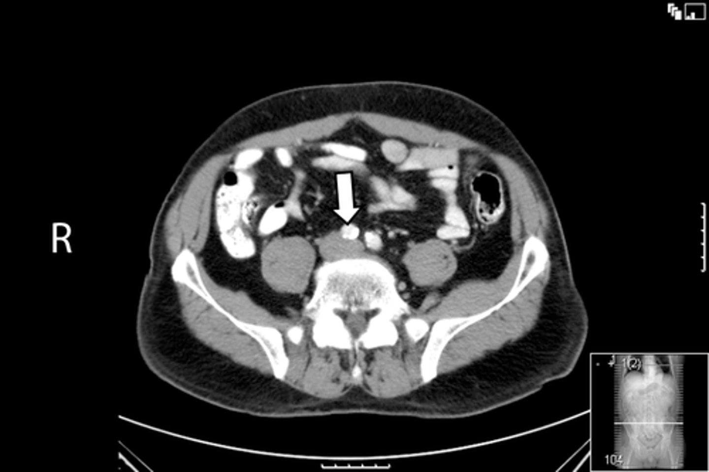 <p>What is indicated in the image?</p>