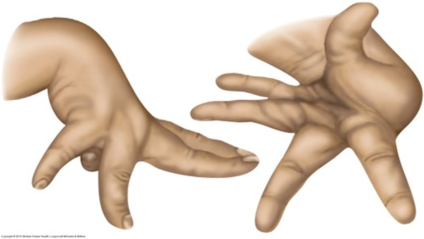 <p>Type of involuntary movement of the body, face, and extremities</p><p>slower, twisting movements</p>
