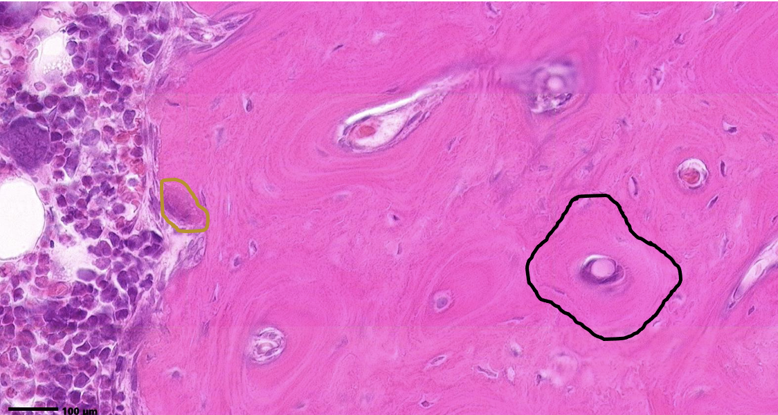 <p>ID the entire structure within the black circle. ID the cell within the brown circle. Does it have PTH receptors?</p>