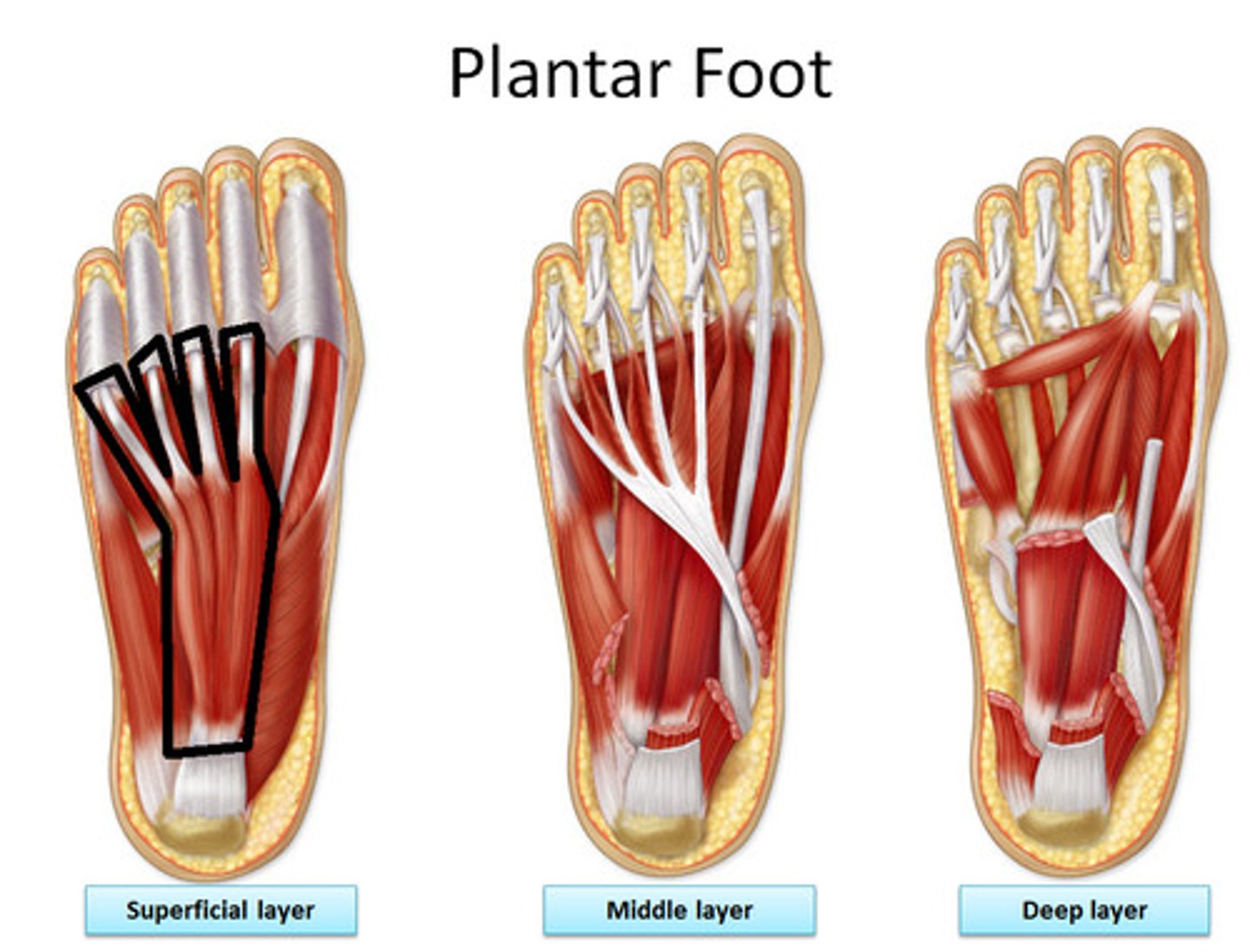 <p>Origin: medial tubercle of tubersoty of calcaneus, plantar aponeurosis, and intermuscular septa</p><p>Insertion: both sides of middle phalanges of lateral four digits</p><p>Innervation: medial plantar nerve (S2, <strong>S3</strong>)</p><p>Action: flexes digits II-V (lateral four digits)</p>