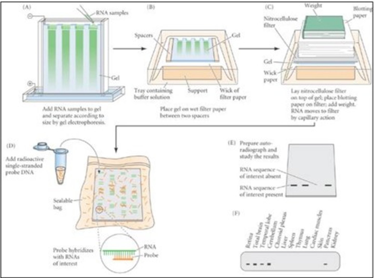 <p>-take two samples: samples of the DNA of the same organism put in two different environments to see the gene transcriptions of both samples of a specific gene (how that gene expression would differ in different environments)</p><p>~the example used: bacteria grown in glucose vs galactose</p><p>-extract the mRNA from both samples</p><p>-purify mRNA (with different techniques)</p><p>-put the mRNA of both samples on an agarose gel that separates different mRNA</p><p>-different mRNA separate based on size</p><p>-transfer the mRNA onto a piece of paper (because the gel is thick and it's hard to interpret results)</p><p>-mix a probe of DNA (labelled single-stranded galactose DNA ) with the transfer mRNA on the paper</p><p>-over time, gene probe will complementary base pair with galactose mRNA</p><p>-because one of the samples will have more galactose mRNA than the other (because it had higher gene expression) there will be more DNA probes binding to it</p><p>-put an x-ray sheet on top of the new mix (mix with the bound DNA)</p><p>-one of the samples will show a black line</p><p>the line represents the bounded DNA probe to mRNA</p><p>-the bigger and darker the line, the greater is the level of transcription as there is literally more mRNA that is present</p>