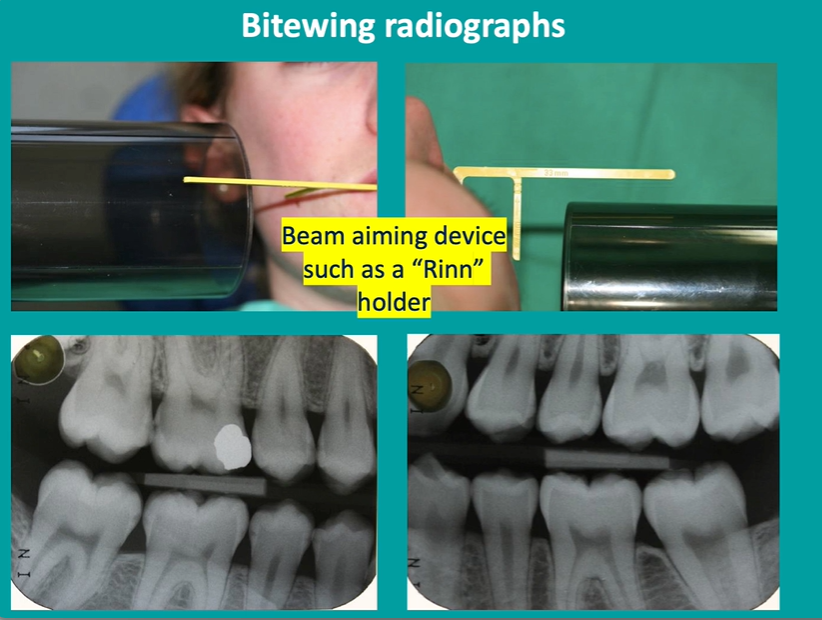 <p>electrons need to hit the detector at 90 degrees so we get no crossover of the contact areas </p>