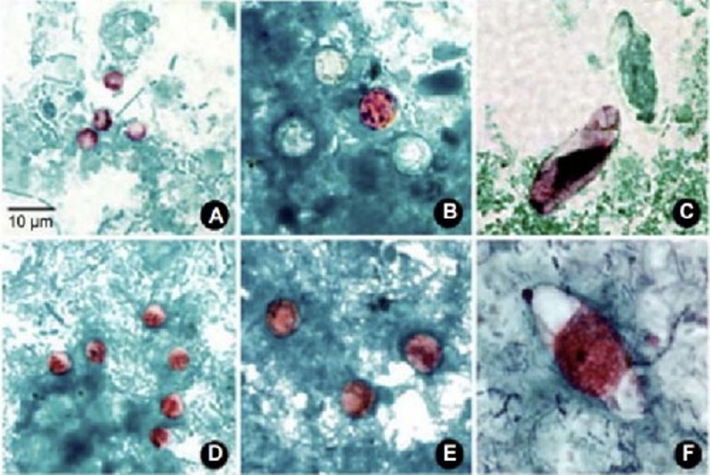 <p>• Stool samples</p><p>• Modified acid fast</p>