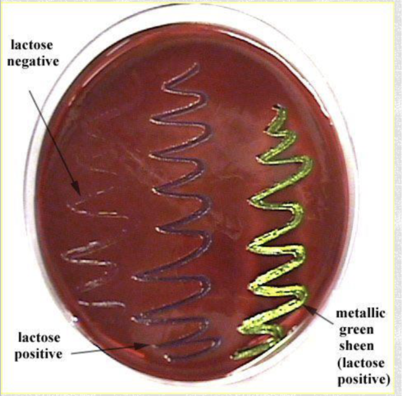 <p>Type: Selective, Differential, and Enrichment&nbsp;</p><p>Selective: Eosin Y and methylene blue are Ph indicator dyes inhibit the growth of most Gram Postive organisms (only GRAM NEGATIVE grow)</p><p>Differential: </p><p>Lactose fermenting gram negative bacteria - purple or metallic green</p><p>Slow lactose-fermenters - pink&nbsp;</p><p>Non-lactose fermenters - colorless or pink&nbsp;</p><p>Enrichment: Sucrose and lactose utilized as fermentable carbohydrates which encourage growth of some gram negative bacteria&nbsp;</p>