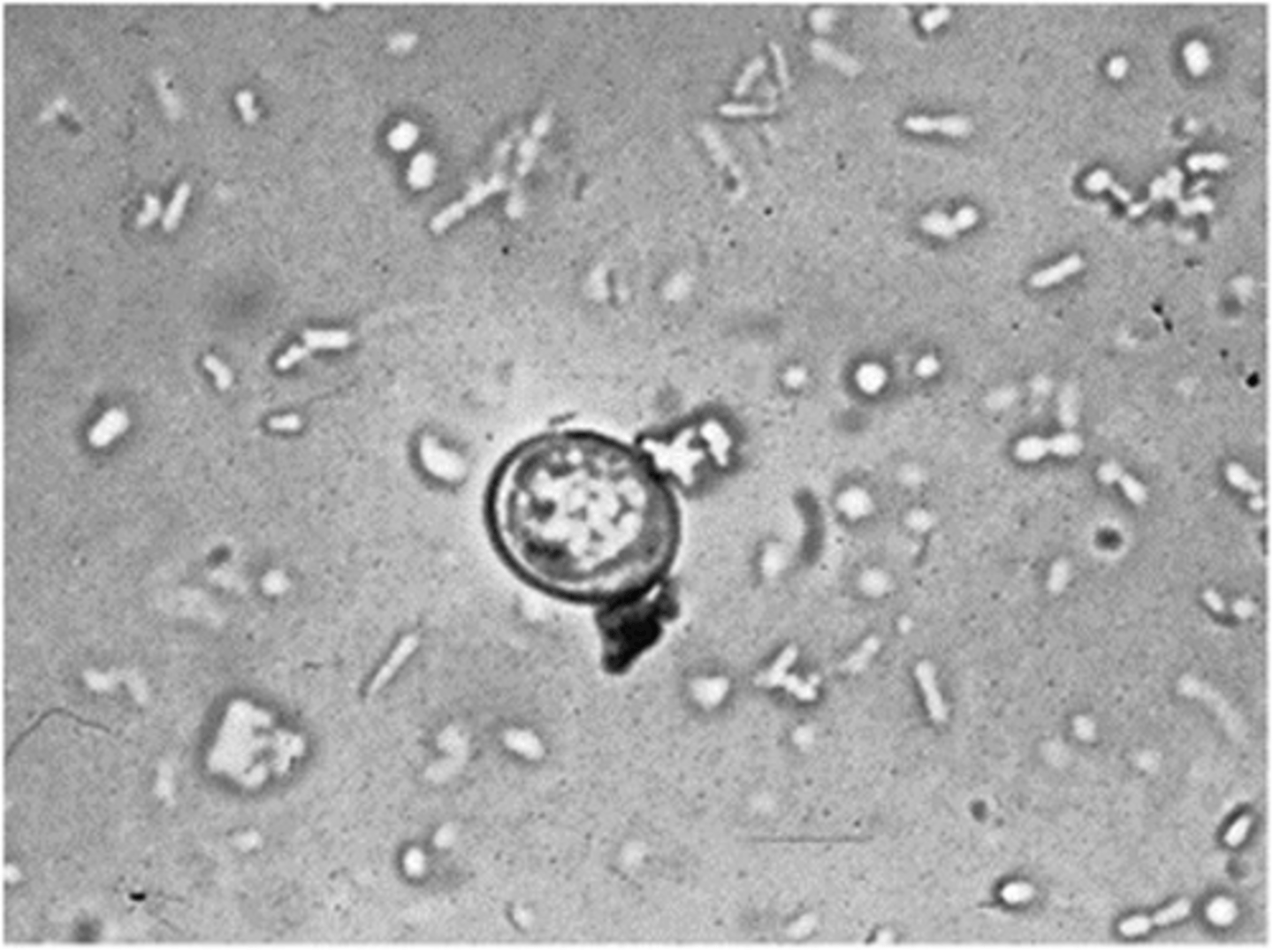 <p>Identify this oocyst as to genus and species. The definitive host is the cat and the parasite</p><p>can only produce oocysts in the cat host. This is a zoonotic protozoan parasite.</p>