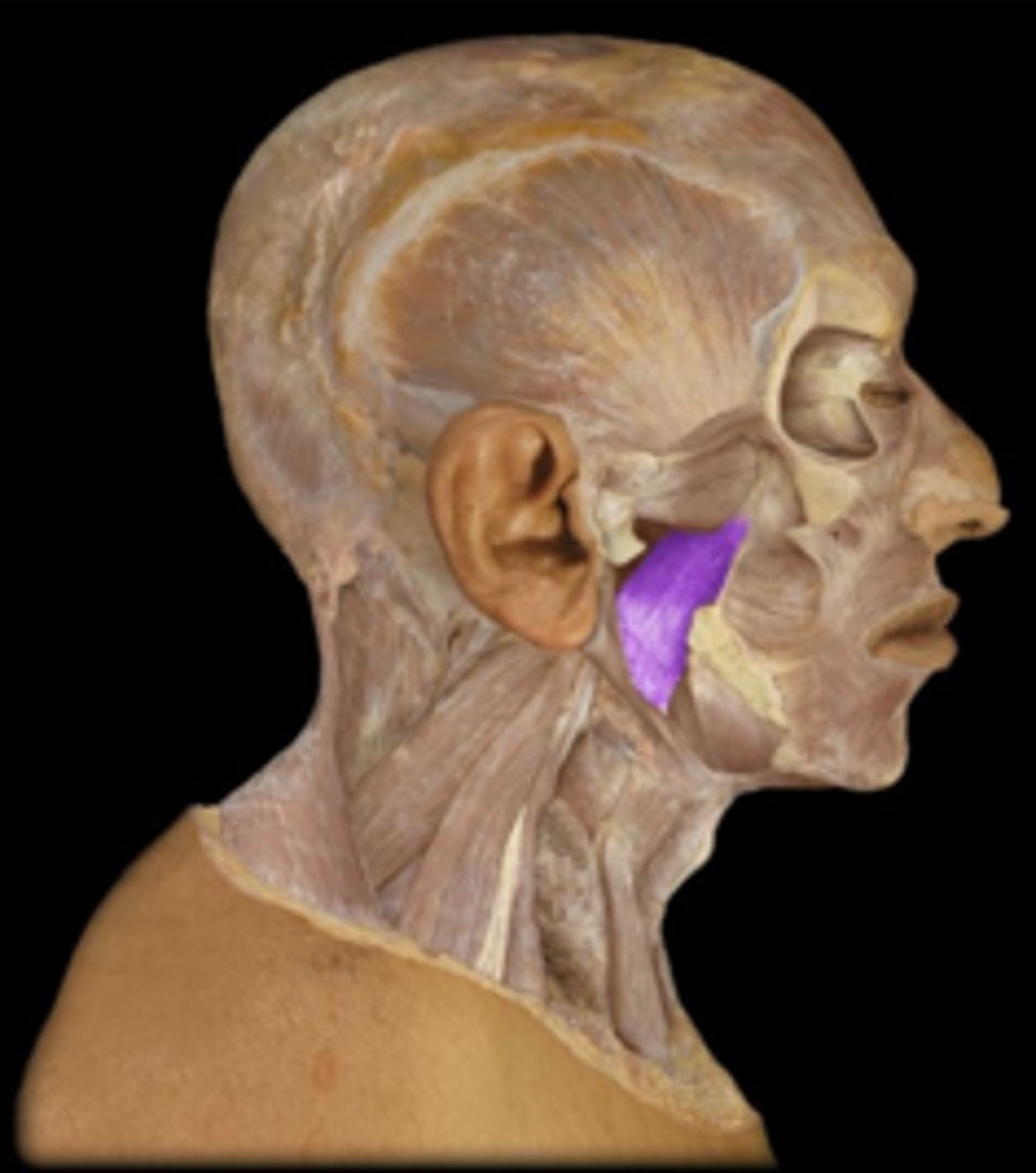 <p>What is the name of this muscle, highlighted in purple and indicated by the arrow?</p>