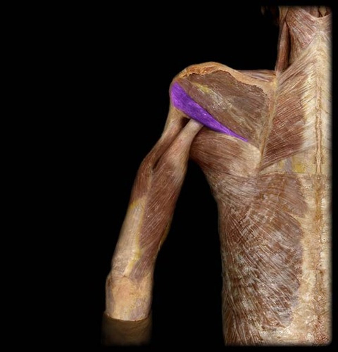 <p>On the lateral border of the scapula</p>