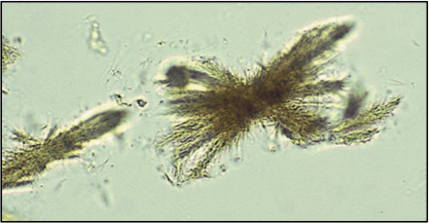 <p>- needles in clumps/rosettes<br>- seen w/ pos. bilirubin<br>- acidic</p>