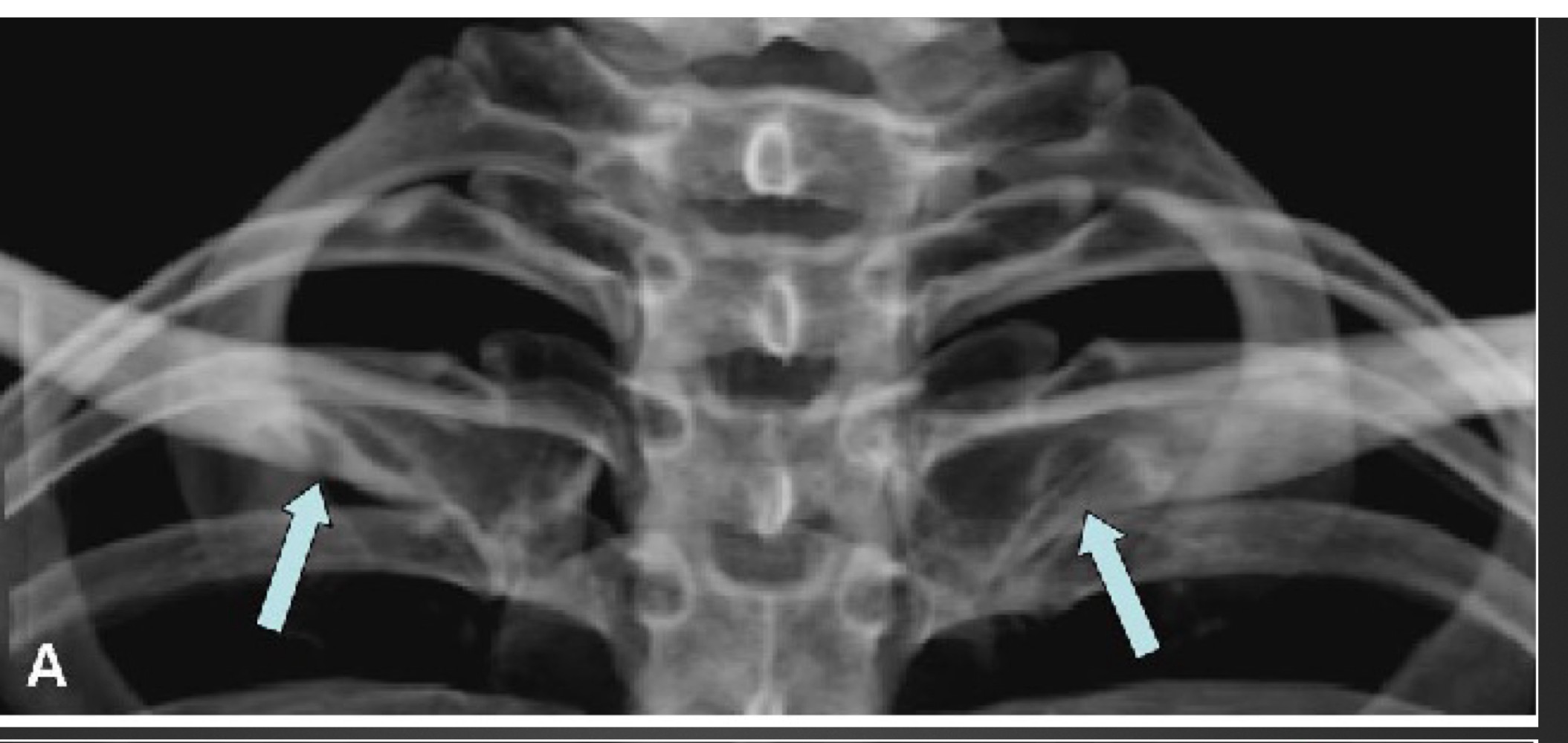 <p>what is this anomaly called </p>