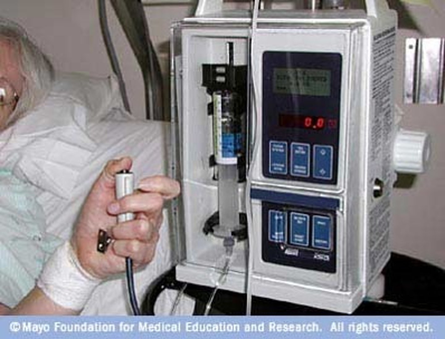 <p>patient-controlled analgesia administered intravenously with a machine</p><p>Only to be pressed by the patient!</p><p>Look for # times button pressed and doses received</p><p>-If they press 27 times tells us they are in a lot of pain</p><p>-If they press 1 time tells us they may not need PCA</p><p>•Adverse events occur 50% less with PCA than usual therapy</p><p>•Safe method for post-op, traumatic, or cancer pain</p><p>•Syringe is a prescribed opioid: morphine, fentanyl, or hydromorphone</p><p>***2nd RN must cosign the amount and machine setting***</p>