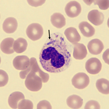 <p>What characteristics is this neutrophil showing?</p>