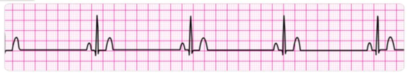 <p>- Slowing of heartbeat during dives</p><p>- Order Cetacea</p><p>- The blood supply is cut off from some organs during dive (some muscles, digestive system, kidneys) blood is shunted to the CNS [brain]and heart)</p>