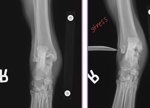 <p><span style="background-color: transparent;"><strong>Fracture Classification</strong></span></p>