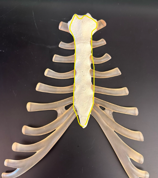 <p>What is circled in yellow?</p>