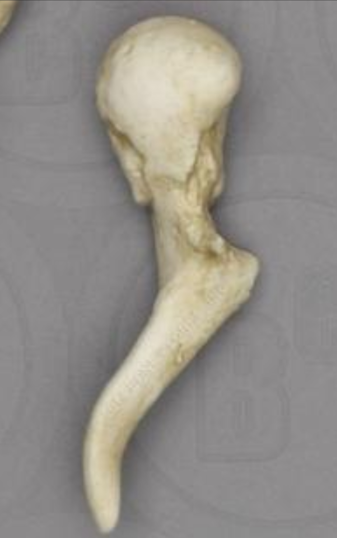 <p>What auditory ossicle is this</p>