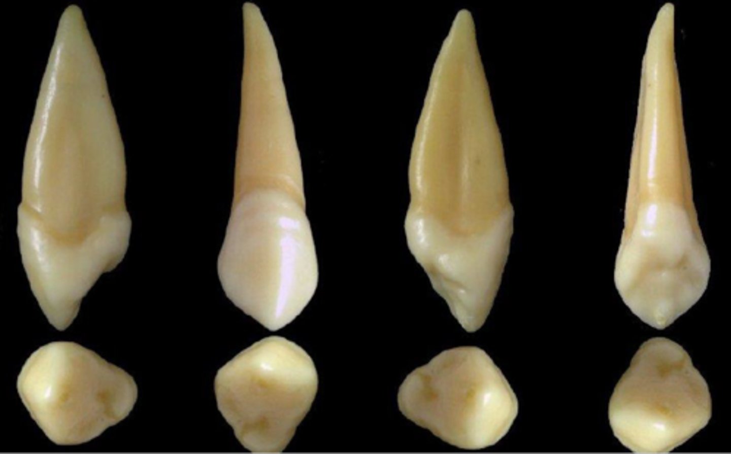 <p>what tooth is this &amp; why?</p>