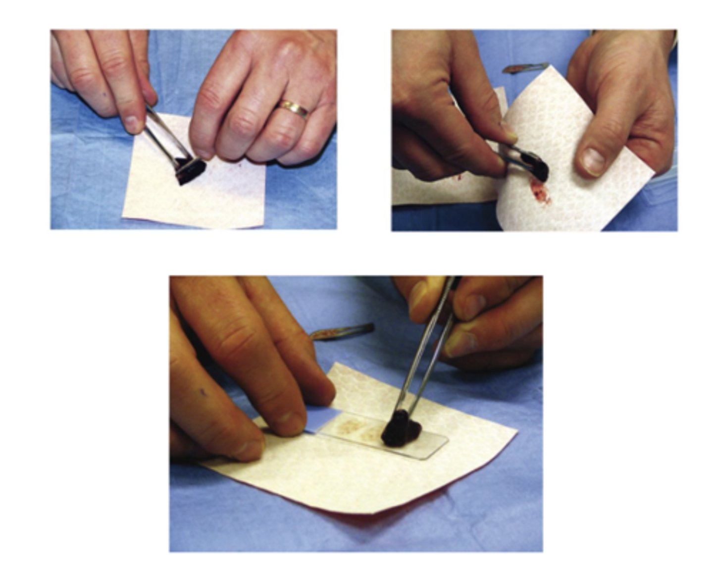 <p>What slide prep method is this?</p>