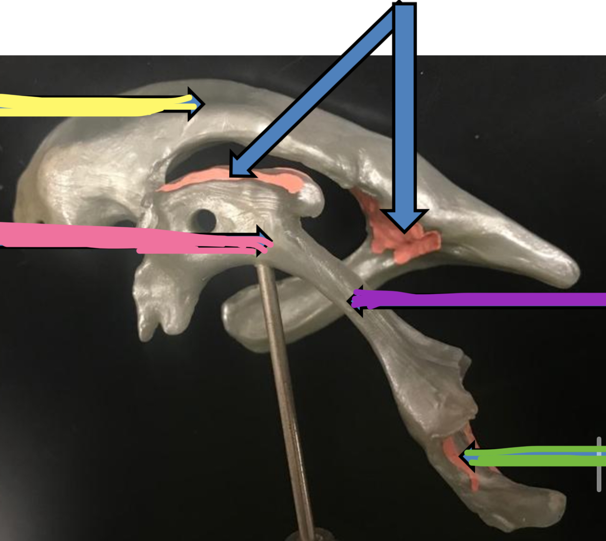 <p>Green points to what part of the ventricles of the brain</p>