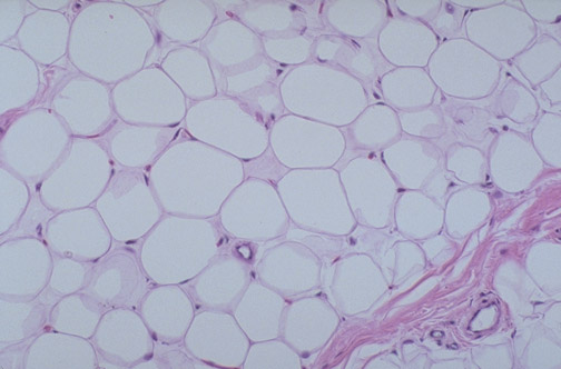 <p>what type of tissue is this (subtype and type)</p>