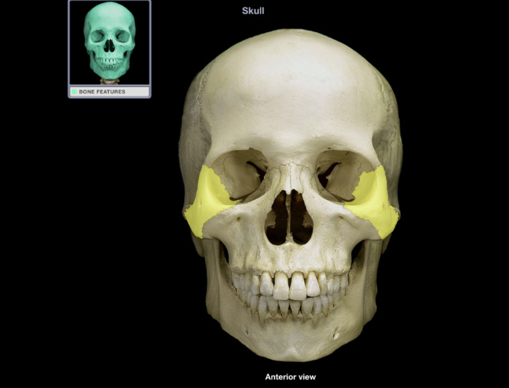 <p>Zygomatic bone</p>