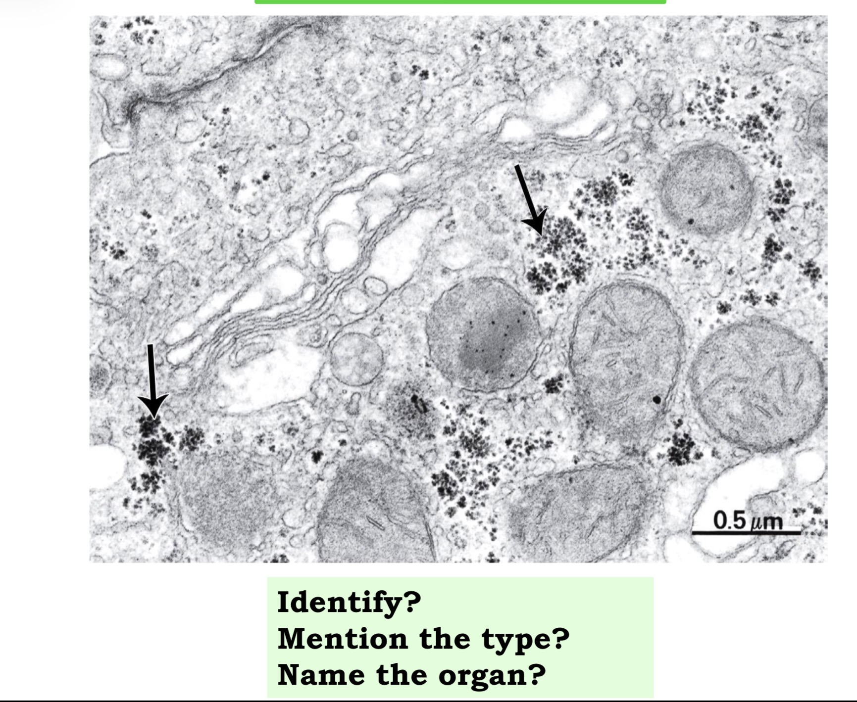 <p>Answer the questions in these following pictures</p>