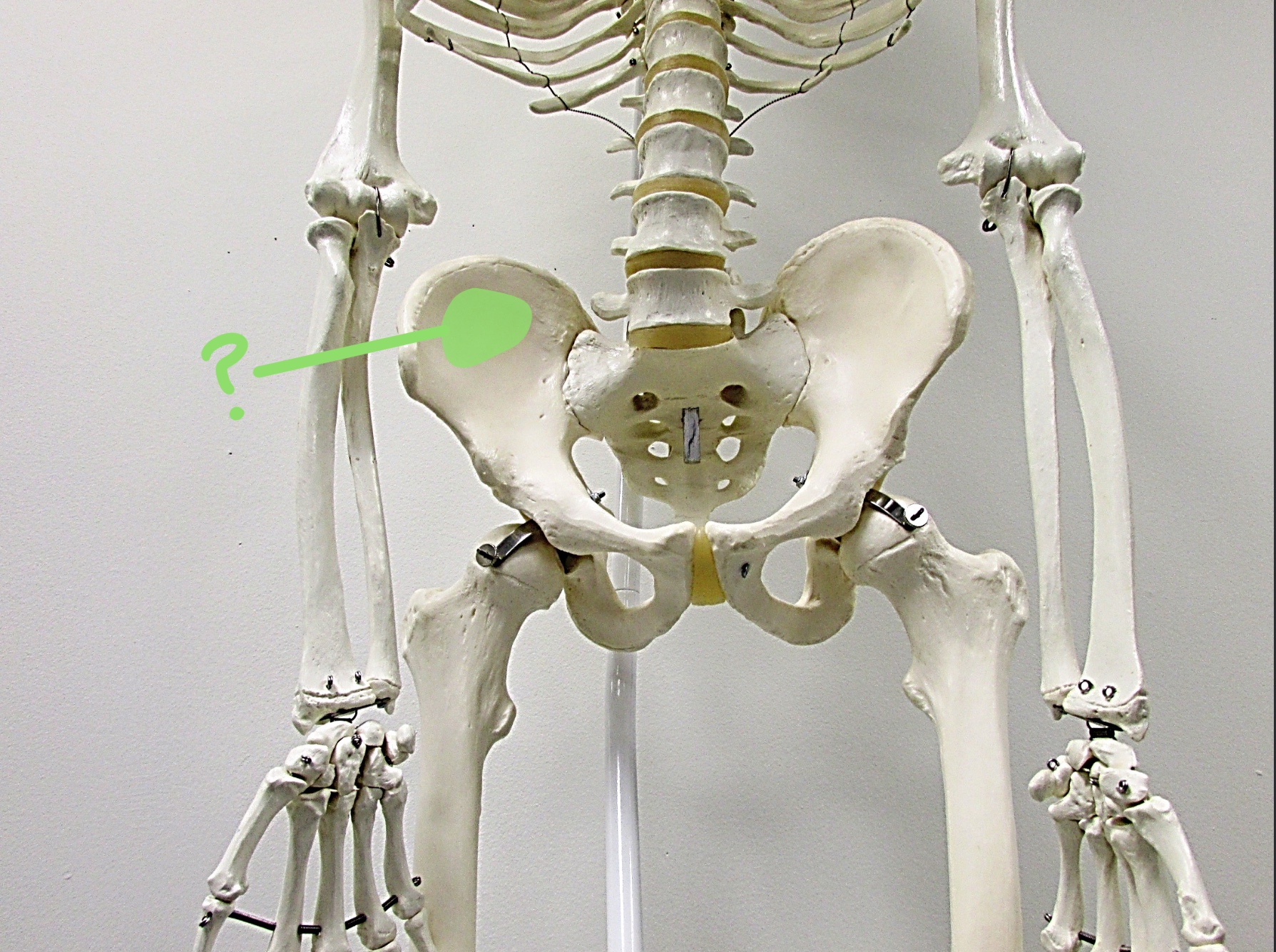 <p>Determine the part of the Coxa/Sacrum highlighted</p>