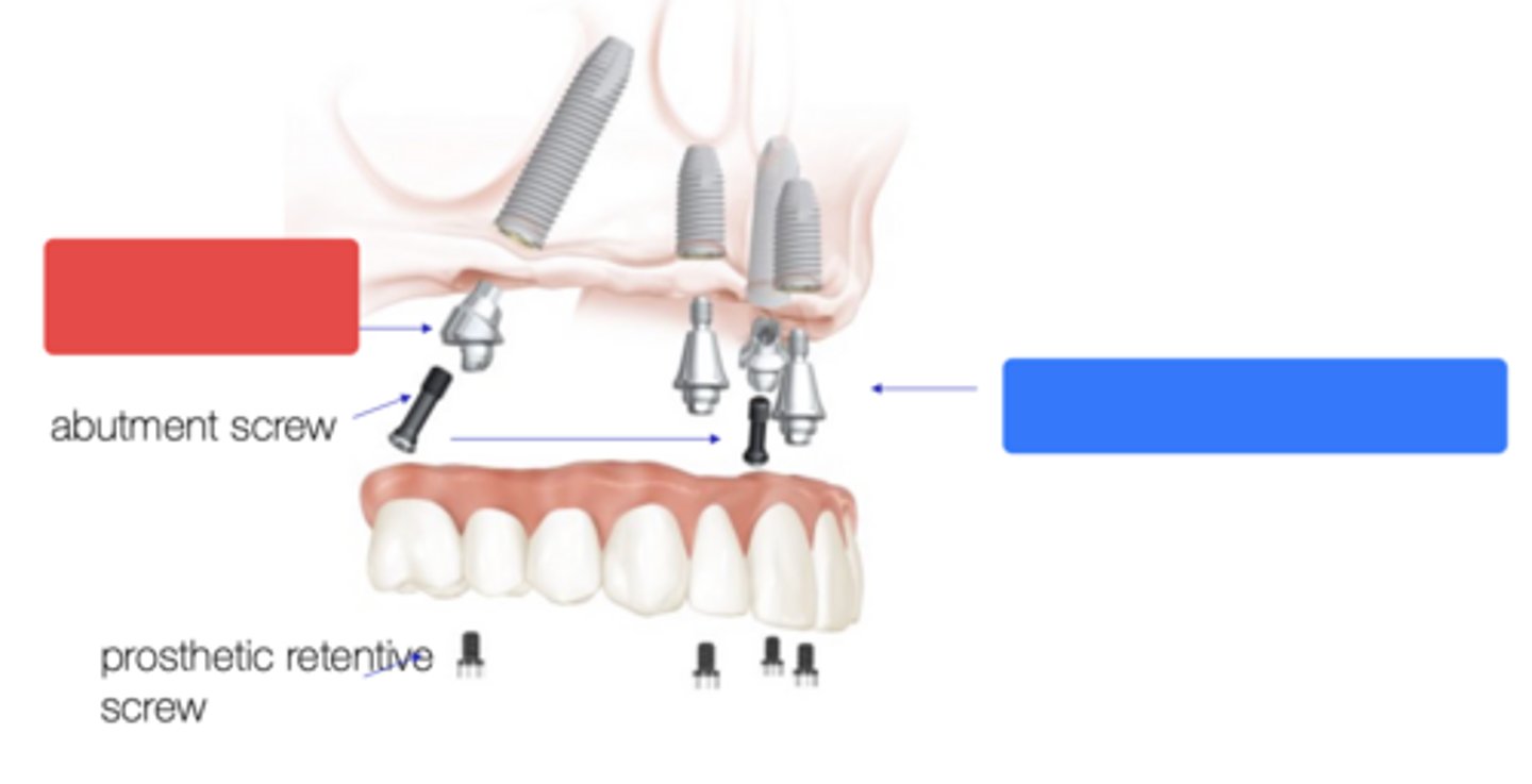 <p>What type of abutment at the red box?</p>