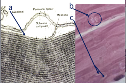 <p>Which structure(s) match(es) both the image(s) and characteristic(s)?</p><p>A) Cell membrane of Schwann cells – form the myelin sheath around axons</p><p>B) Node of Ranvier – Where two fibroblasts join around the same axon</p><p>C) Schmidt-Lantermann cleft – complete compaction of myelin around an axon</p><p>A and B</p><p>A, B, and C</p>