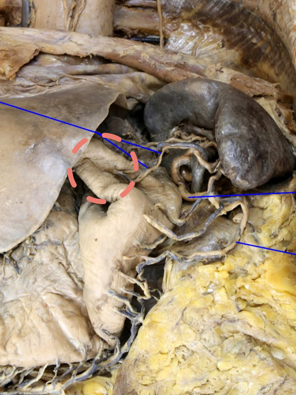 <p>A). Identify this structure<br>B). What supplies blood to this structure?</p>