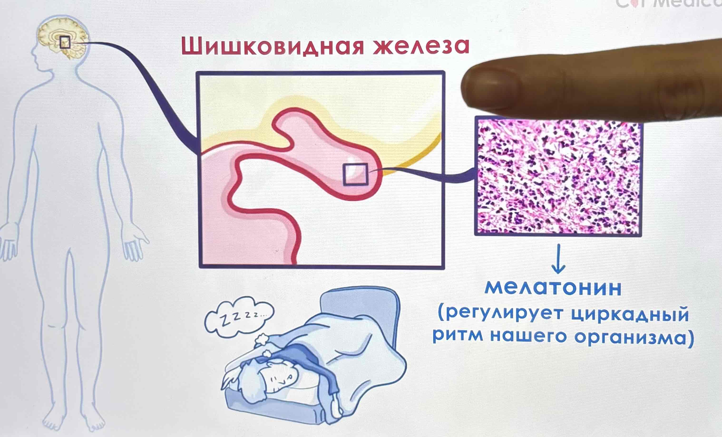 <p>Шишковидная железа состоит из клеток которые называются </p>