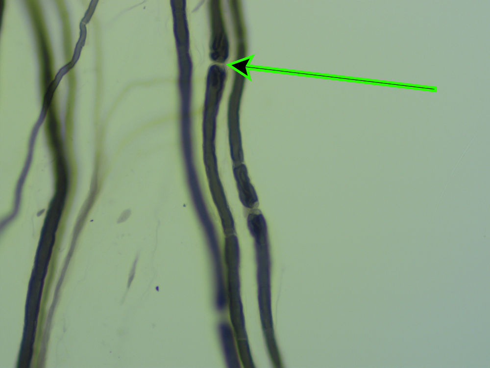 <p><em>[Quiz - Lab 2.1 (Neurophysiology and EEG): Check Your Understanding]</em><br><strong>ID specific structure (light) at the end of the pointer.</strong></p><p>a. myelin sheath</p><p>b. Schwann cell</p><p>c. reticular fiber</p><p>d. node of Ranvier</p>