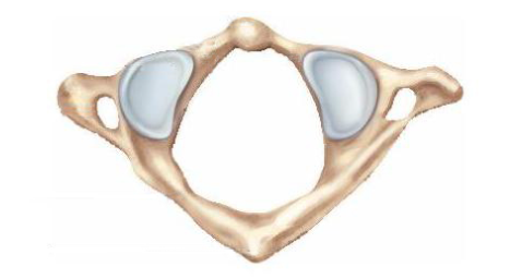 The specific name of the vertebra shown in the figure is the